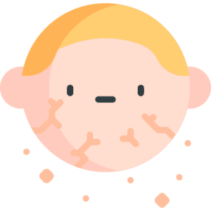 dry skin