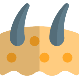 epidermis